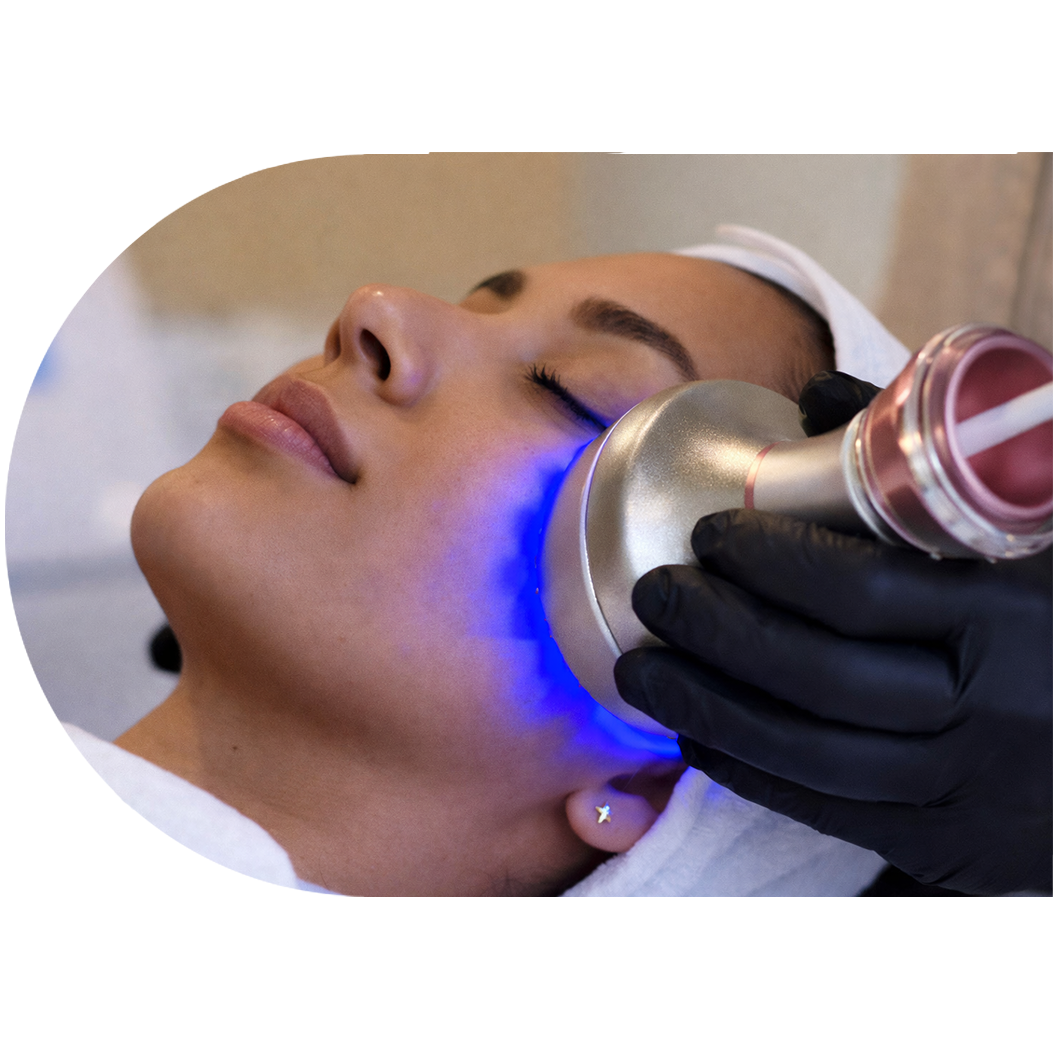 Atua reduzindo imperfeições (borbulhas, pápulas, pústulas), acalmando a irritação e prevenindo o reaparecimento de novas marca